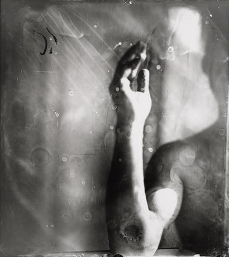 SallyMann_ProudFlesh_I.jpg