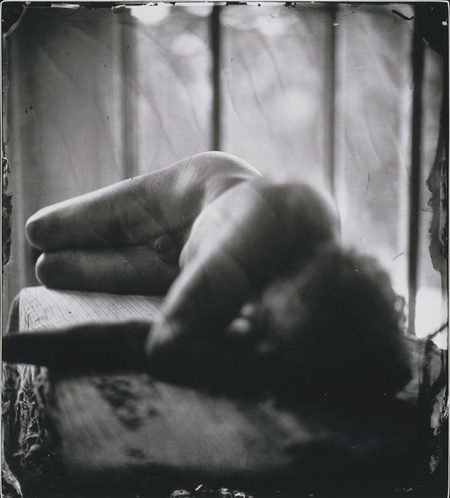 SallyMann_ProudFlesh_III.jpg