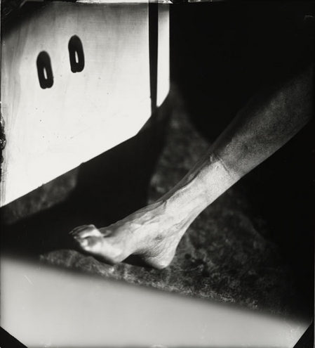 SallyMann_ProudFlesh_XVIII.jpg